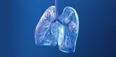  Lung Cancer Diagnosis and Staging